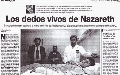 Reimplante de la Mano de Nazareth