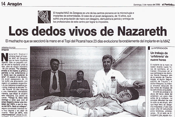 Reimplante de la Mano de Nazareth